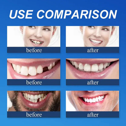 Ends Today: 70% OFF! ⏰70% OFF! EETTSY™ Medical Full Denture with Strong Suctiond Custom-Fit Full Functional Dentures🦷Obtain American Dental Association (ADA) Certification